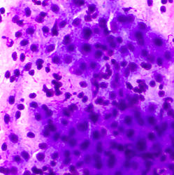 cytocore diacor srbija biopsija mekih tkiva uzorkovanje