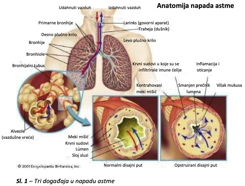 anatomija napada astme