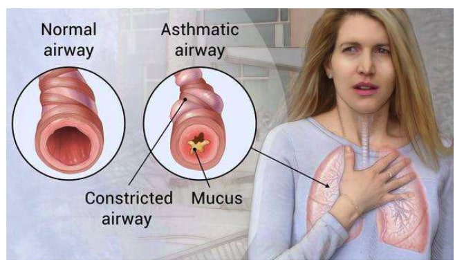prekomerno%20stvaranje%20sluzi min