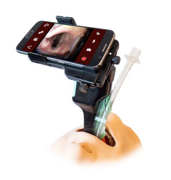 adapter za telefon airtraq diacor